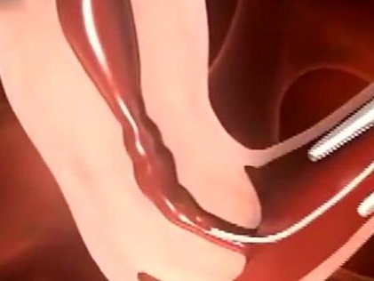 试管婴儿移植：冻胚VS养囊，效果与成功率深度对比分析